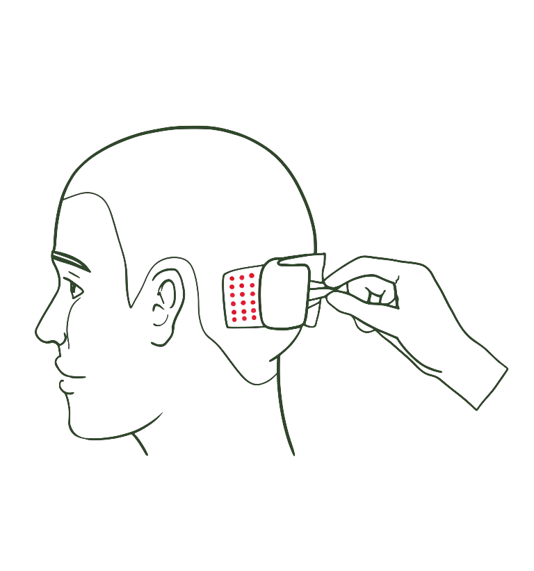 taking off bandage after hair transplant surgery