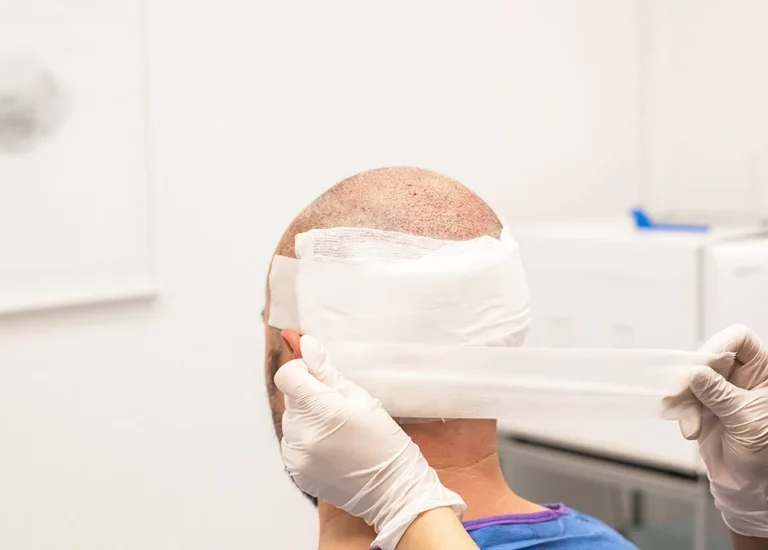 hair transplant bandage removal guide